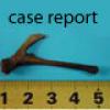نگارش علمی: چگونه یک گزارش مورد (Case Report) خوب بنویسیم؟